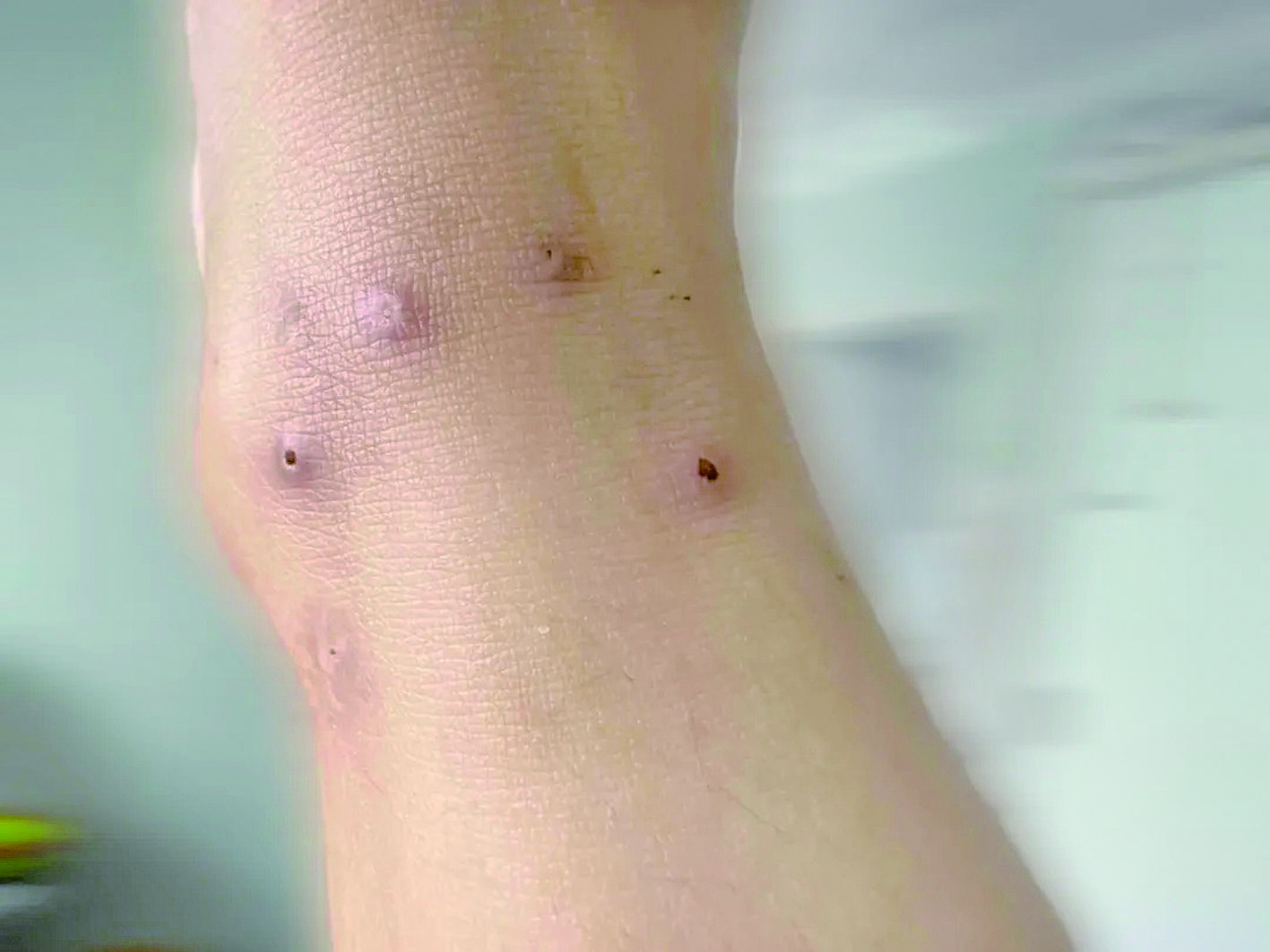 红火蚁已入侵12省份!