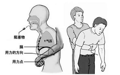 若不想类似悲剧重演 这份护理指南一定要记牢