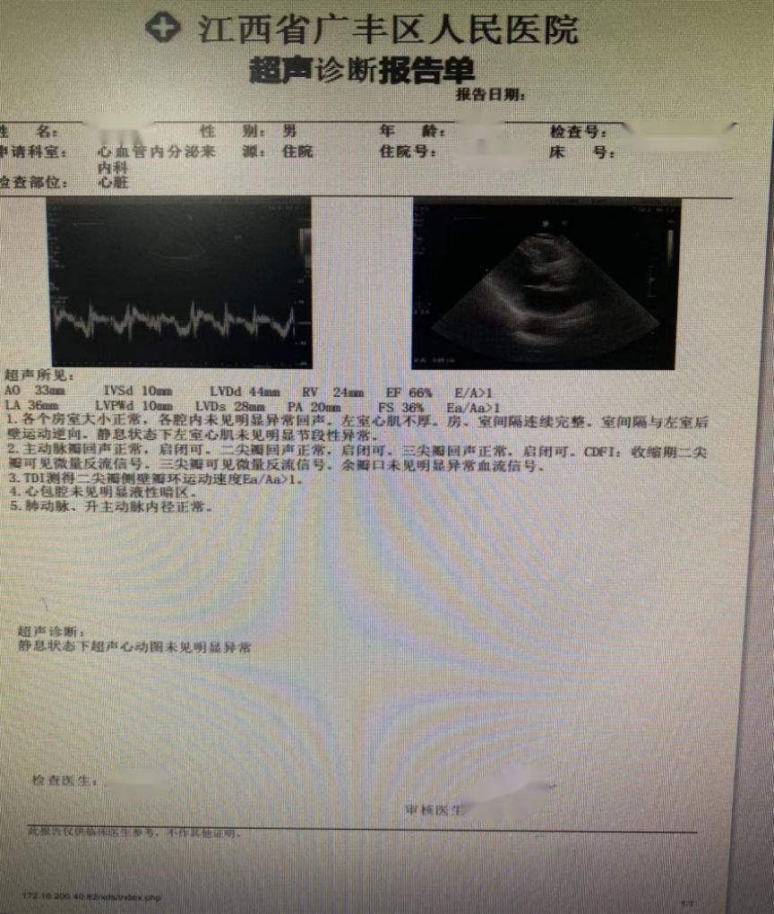 活心丸(浓缩丸)治疗病例之103-冠心病合并慢性心功能不全男性患者