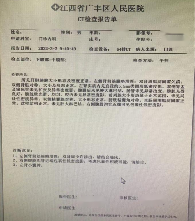 活心丸(浓缩丸)治疗病例之103-冠心病合并慢性心功能不全男性患者