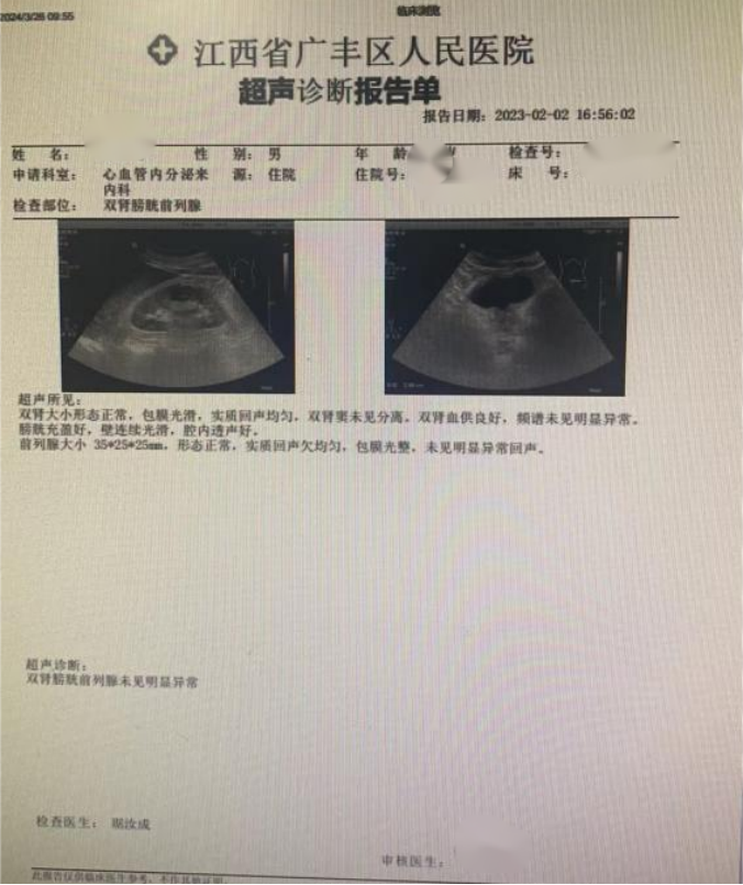 腹股沟疝彩超报告单图片