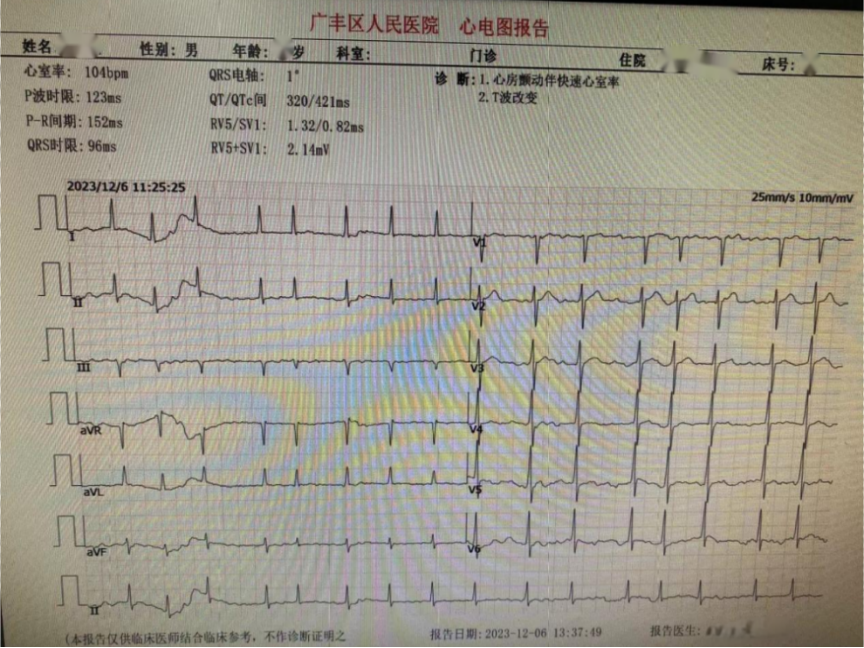 心脏超声(2023年12月6日)示:ef:66%,超声心动图未见明显异常.