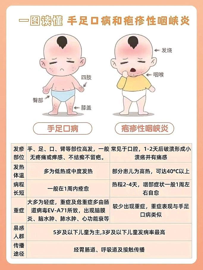 警惕咽峡炎"小泡泡"