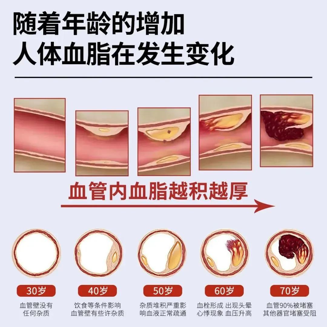 教你选有效的好鱼油,omega-3含量是关键|血脂_新浪财经_新浪网