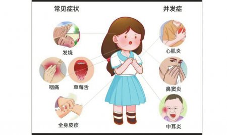 猩红热进入高发季 这些防疫知识要牢记