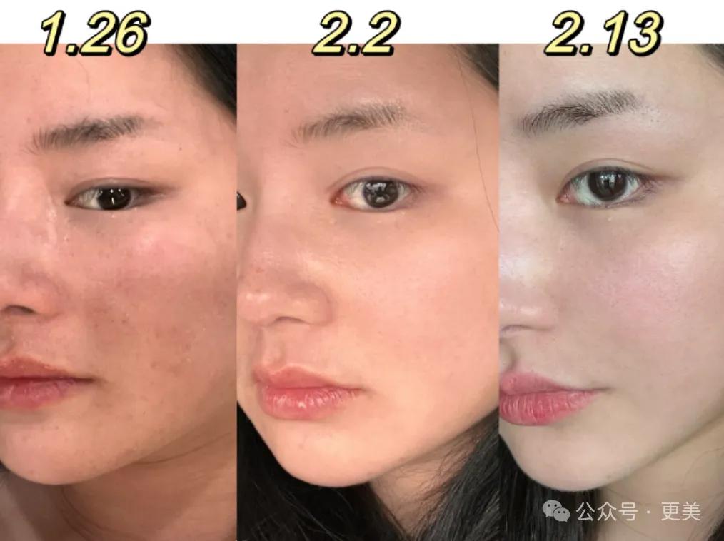 套牢大哥的高干文女主脸,打了多少童颜针啊?