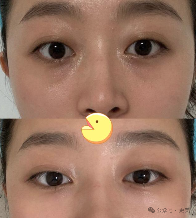 套牢大哥的高干文女主脸,打了多少童颜针啊?