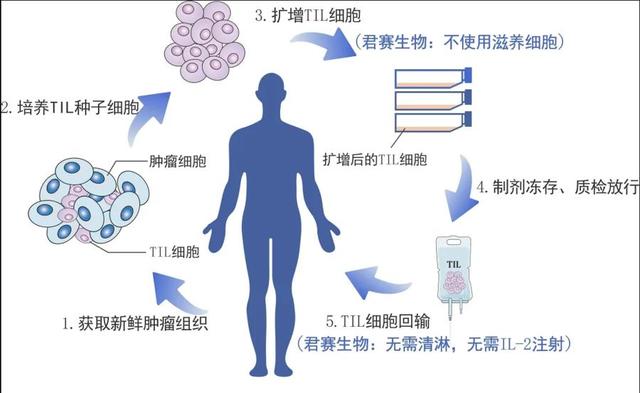 癌症til疗法进入临床试验,给晚期实体肿瘤患者带来希望