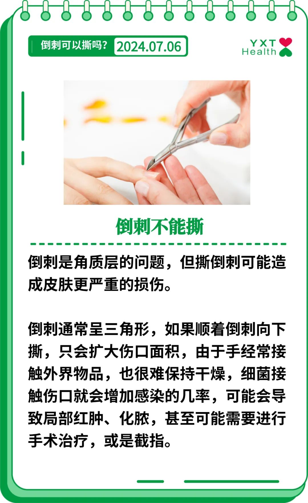 手上长倒刺,可以撕吗?