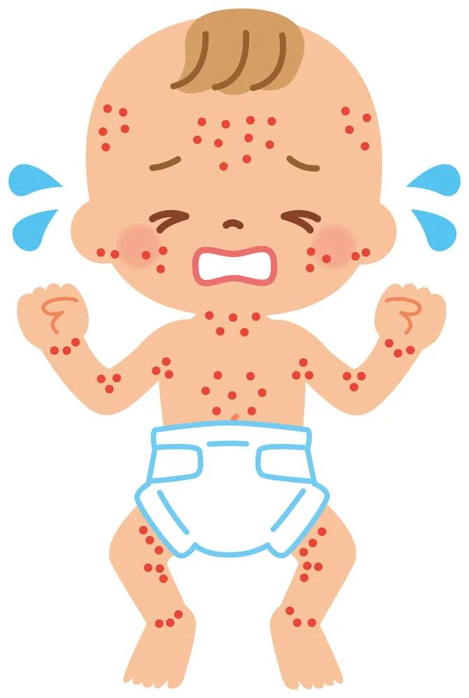 痱子or湿疹?如何护理?记住这几招!