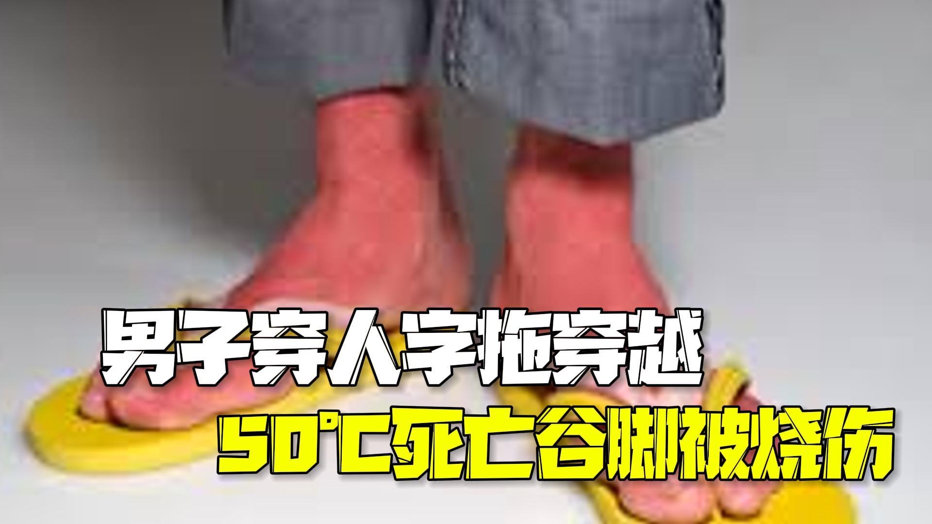 比利时游客穿人字拖穿越50℃死亡谷 鞋坏了就光脚走造成Ⅲ度烧伤_北京