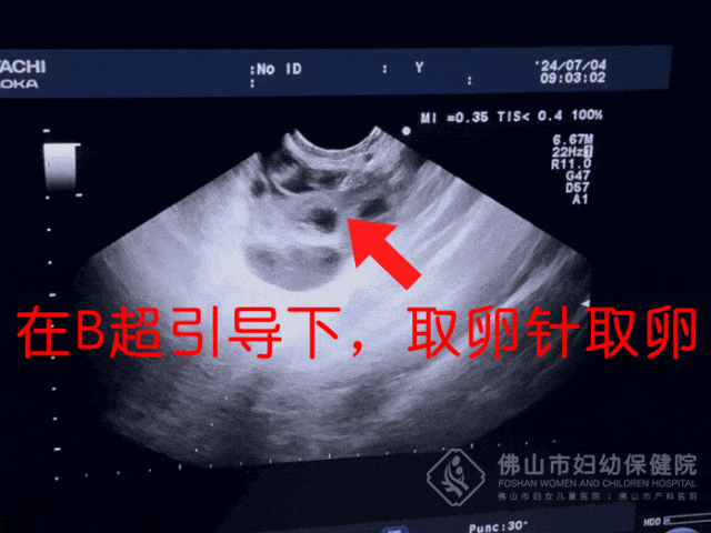 ▲图源：佛山市妇幼保健院