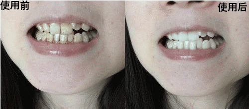 （图为个人使用反馈，实际效果因人而异）