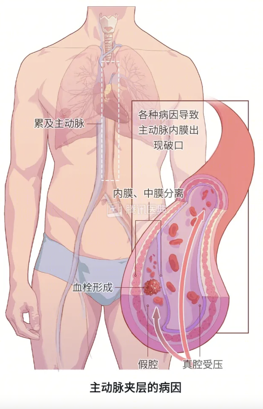 图源：腾讯医典