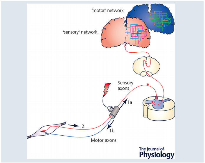 怎么买神经肌肉康复仪神经肌肉低频电刺激技术：重塑大脑功能的康复利器_https://www.jmylbn.com_新闻资讯_第1张