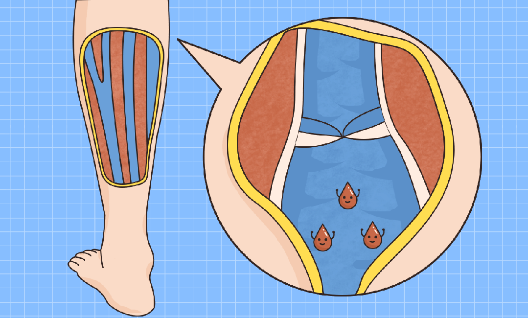 医疗压力袜什么价格这种热销数十万的「瘦腿袜」，我劝你千万别乱买！_https://www.jmylbn.com_新闻资讯_第3张