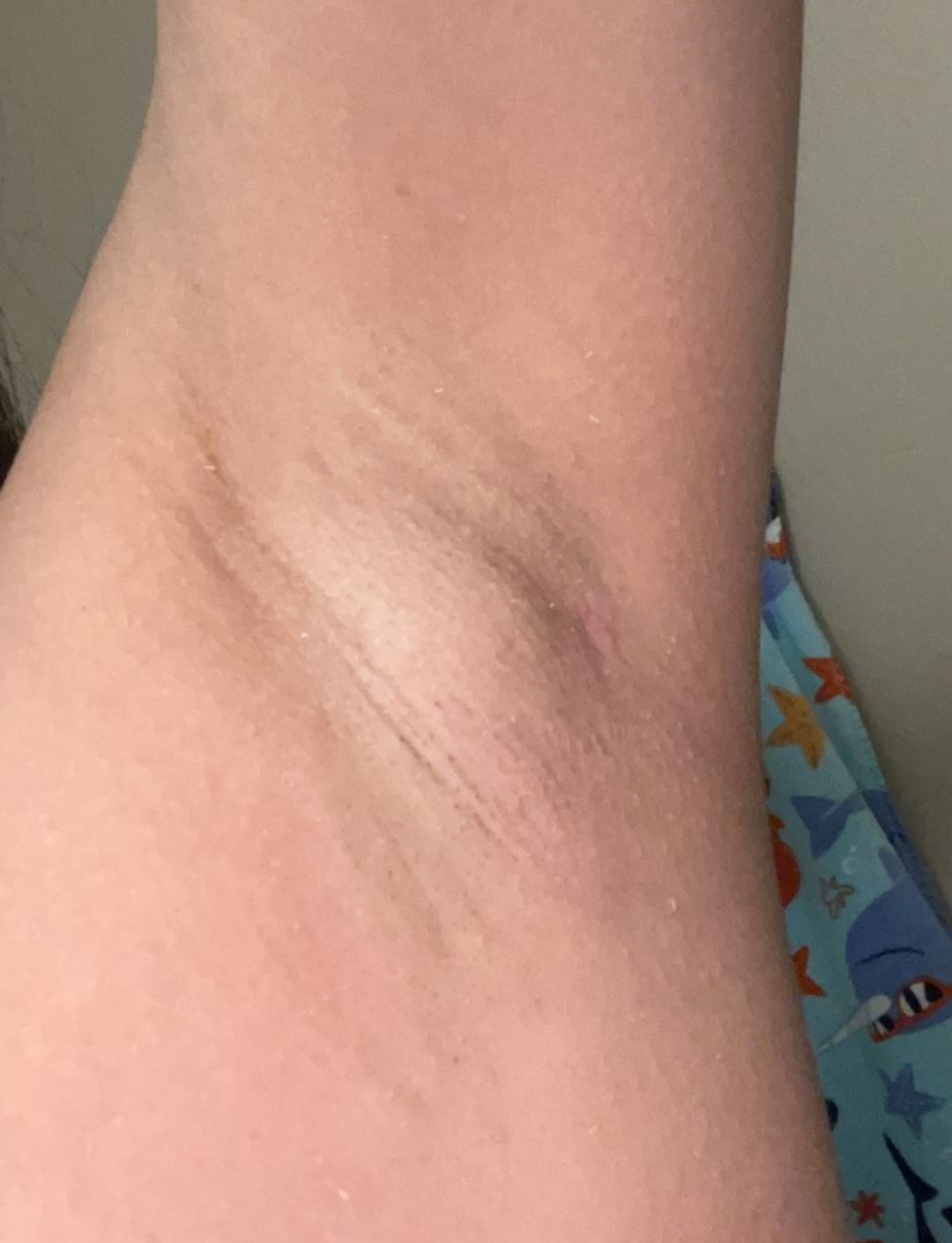 副乳_新浪财经_新浪网