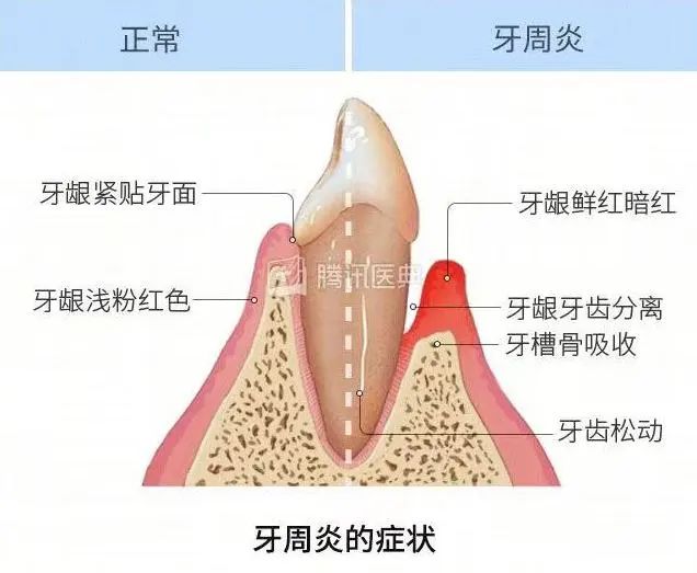 ▲图源：腾讯医典