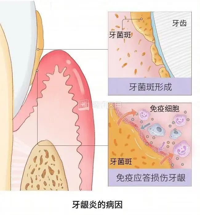 ▲图源：腾讯医典