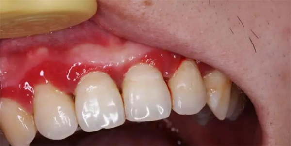 很多人年轻时都不重视|牙齿|牙周炎_新浪科技_新浪网