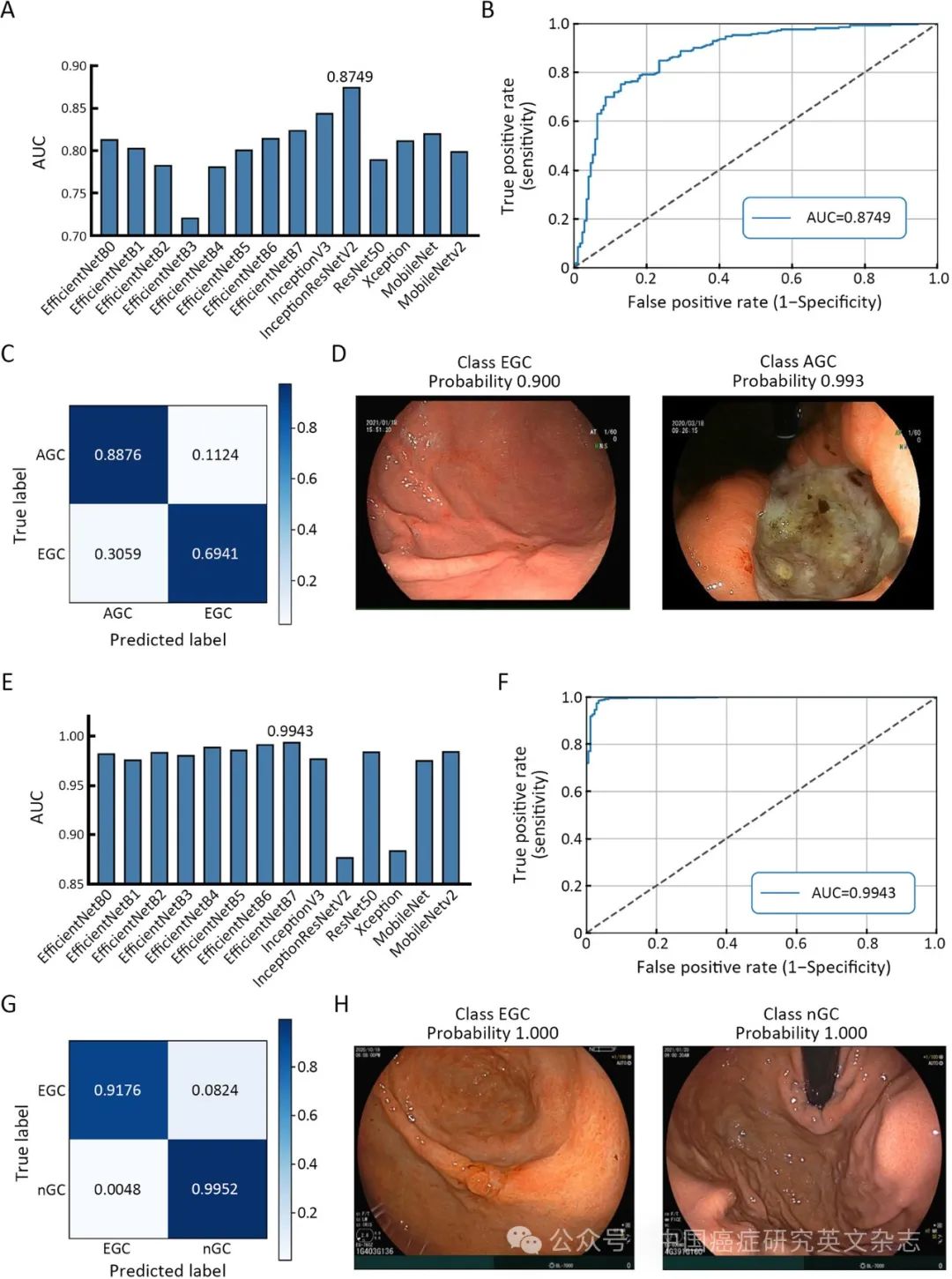 大体标本是什么【论著解读】人工智能看胃镜图片可预判良恶性病变、幽门螺杆菌感染及胃周淋巴结转移_https://www.jmylbn.com_新闻资讯_第7张