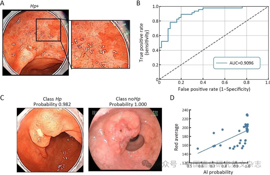 大体标本是什么【论著解读】人工智能看胃镜图片可预判良恶性病变、幽门螺杆菌感染及胃周淋巴结转移_https://www.jmylbn.com_新闻资讯_第8张