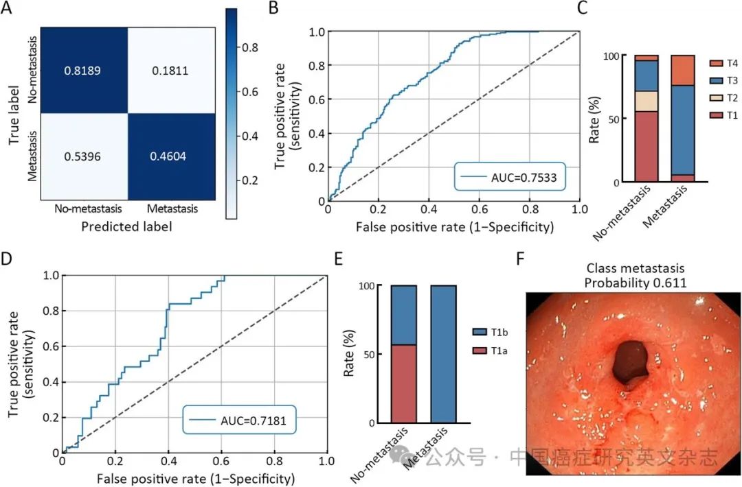 大体标本是什么【论著解读】人工智能看胃镜图片可预判良恶性病变、幽门螺杆菌感染及胃周淋巴结转移_https://www.jmylbn.com_新闻资讯_第9张