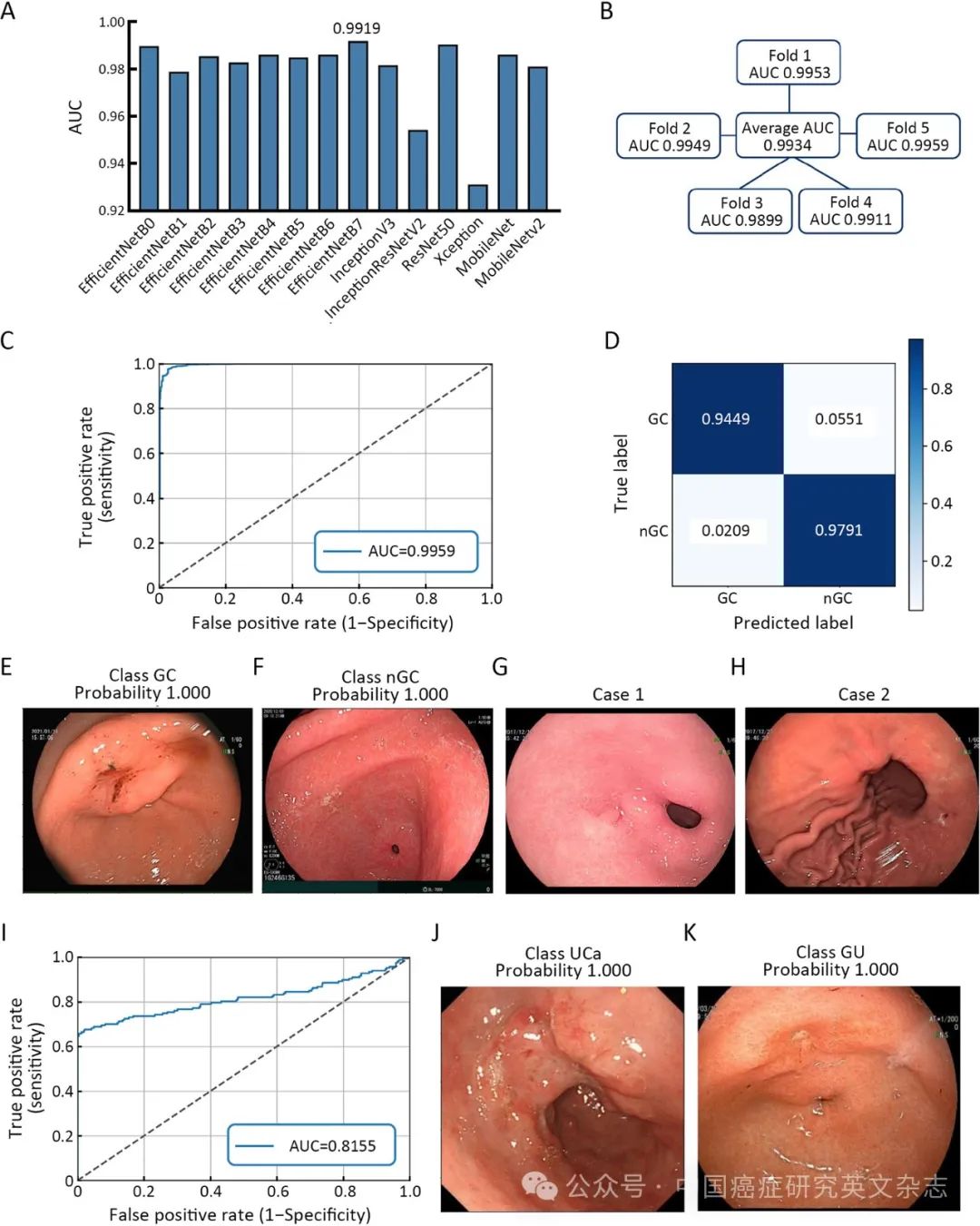 大体标本是什么【论著解读】人工智能看胃镜图片可预判良恶性病变、幽门螺杆菌感染及胃周淋巴结转移_https://www.jmylbn.com_新闻资讯_第6张