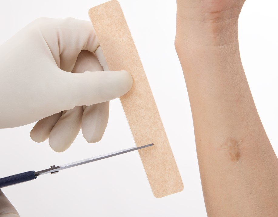 硅凝胶泡沫敷料怎么用专业可靠 康护无忧 ｜ 奥美医疗亮相2024年伤口造口失禁护理新进展学术交流研讨会_https://www.jmylbn.com_新闻资讯_第7张