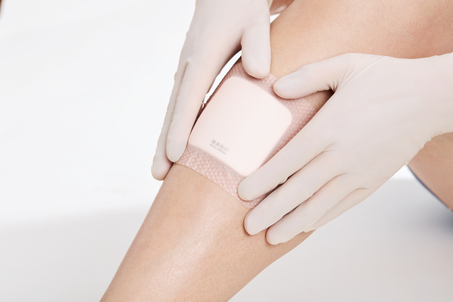 硅凝胶泡沫敷料怎么用专业可靠 康护无忧 ｜ 奥美医疗亮相2024年伤口造口失禁护理新进展学术交流研讨会_https://www.jmylbn.com_新闻资讯_第3张