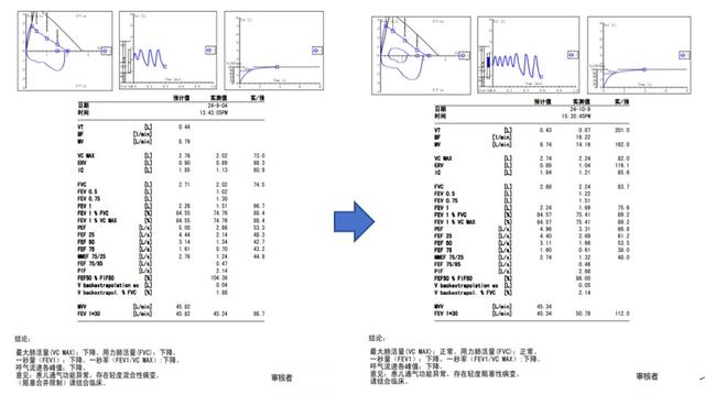 图3:小杰康复前后肺功能报告