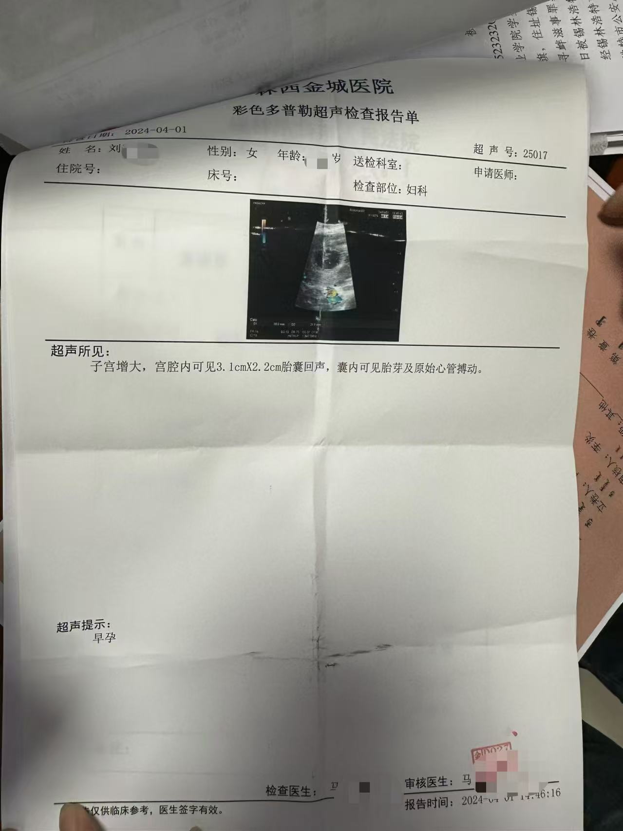 在b超显示孕囊的位置下,竟有一个疑似卡通水印的图案