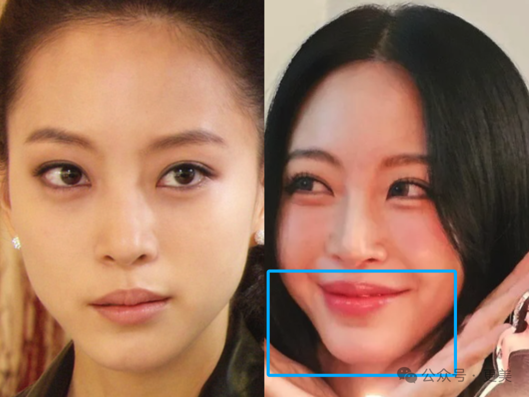 女明星们消失的下颌角集体回归!是玻尿酸捏的吗?