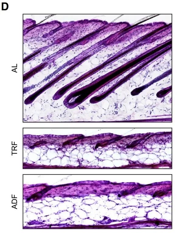 通过H&E染色观察，AL、TRF和ADF条件下小鼠皮肤的组织学切片