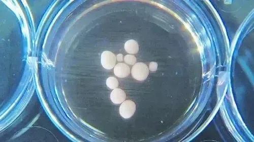 △ 穆奥特里实验室培育的一些大脑类器官。