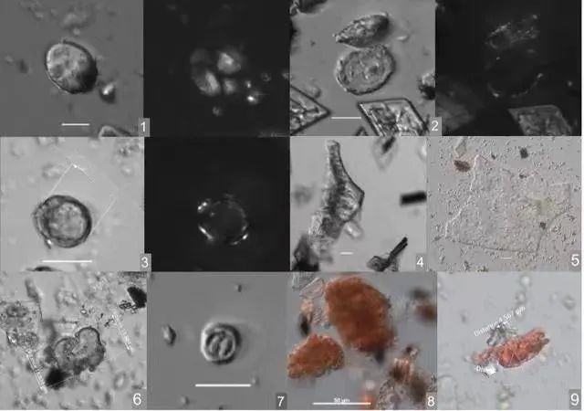 |从仰韶村遗址小口尖底瓶样品中提取到的微体化石，包括淀粉粒、植硅体、霉菌和酵母等。 图源/河南省文物考古研究院