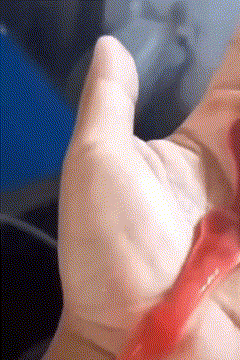 △丝带蠕虫“吐了”