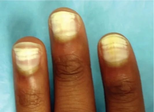 白甲。图片来源：参考文献[6]