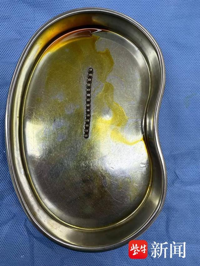 磁力珠对身体有辐射吗_磁力珠有辐射危害吗