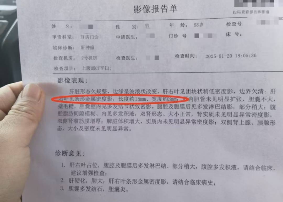 此外,该报告的诊断意见部分也显示,患者有