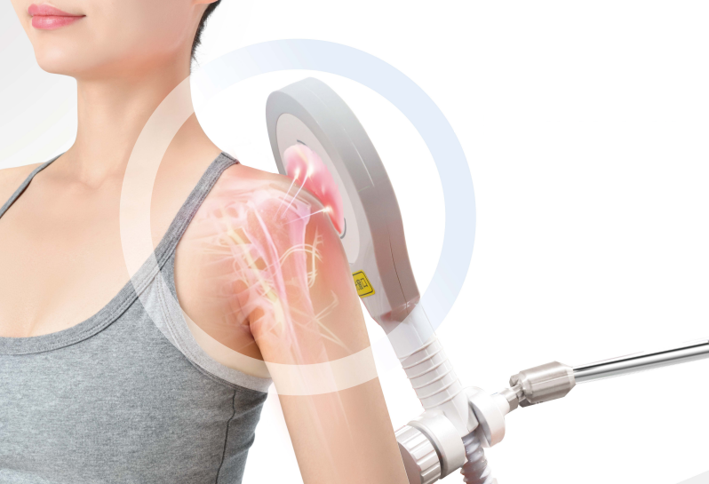 康复治疗激光怎么收费告别疼痛，重拾活力！激光磁刺激技术为您开启无痛新生活！_https://www.jmylbn.com_新闻资讯_第1张