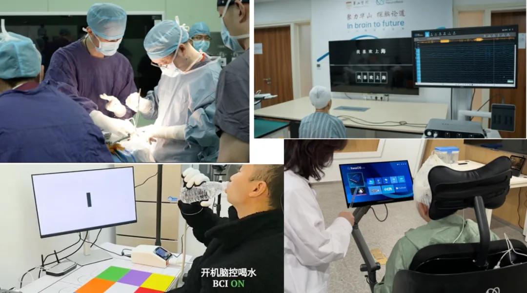 图4.上海医械院型检支撑脑机接口医疗器械进入临床试验