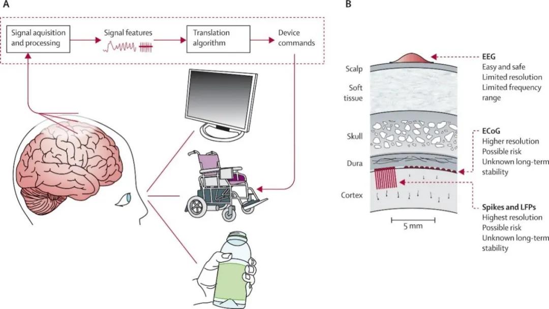 图1.脑机接口技术在医疗中的应用(a)脑机系统(b)脑信号