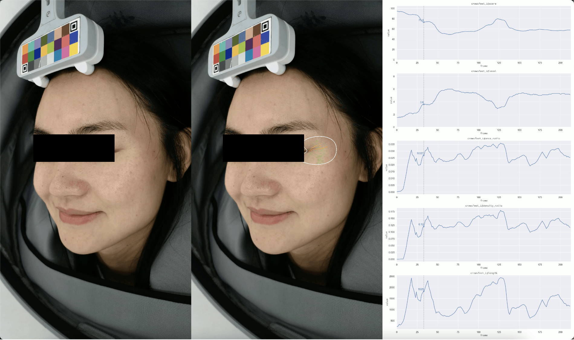 美图宜肤动态纹检测