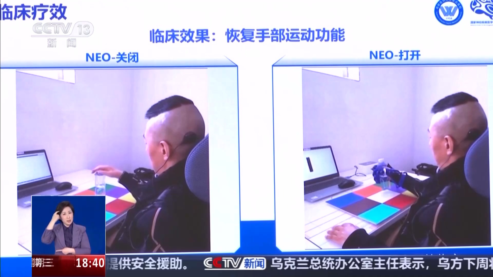 科幻照进现实，脑机接口如何守护生命？