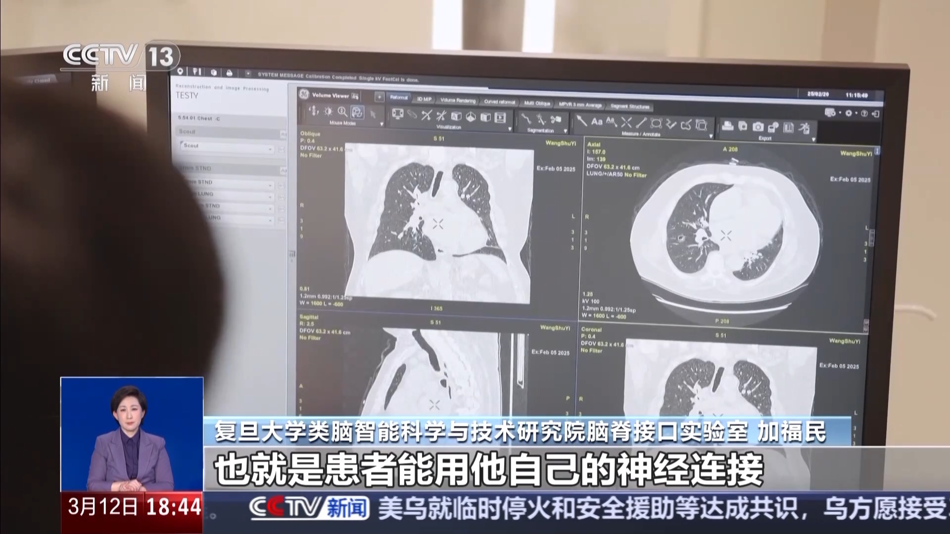科幻照进现实，脑机接口如何守护生命？