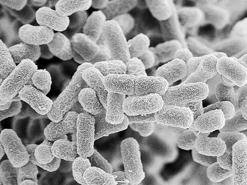 图片来源：Steve Gschmeissner/Science Photo Library