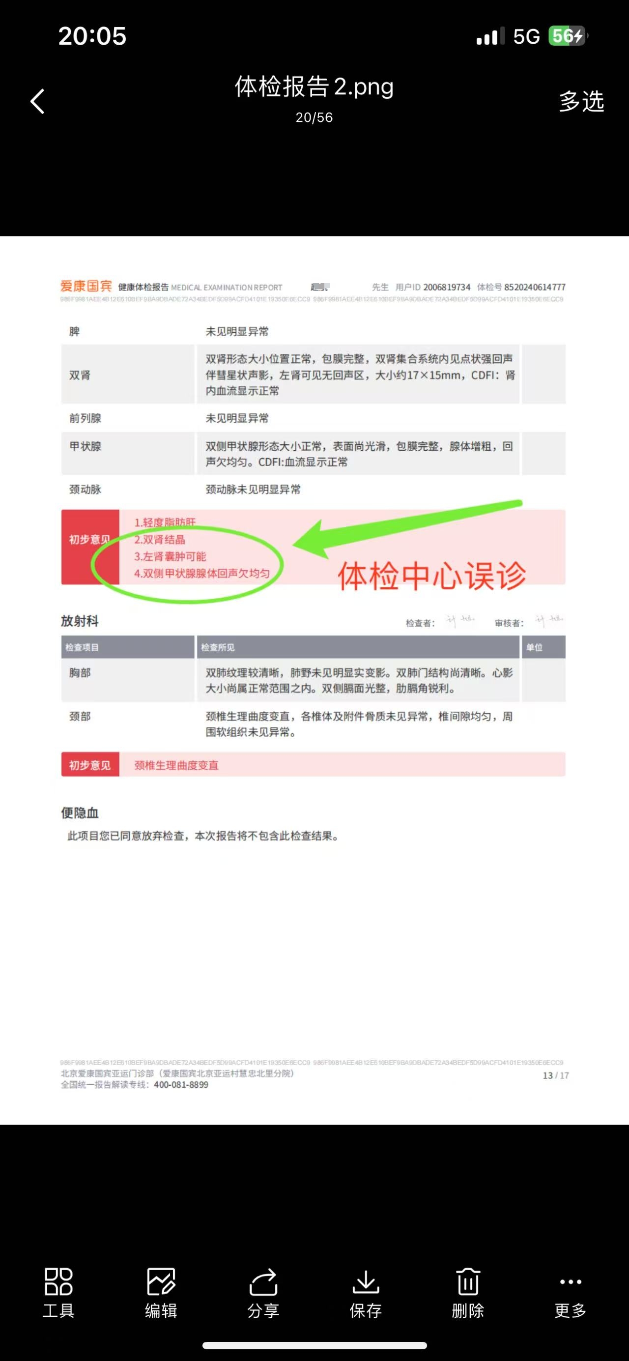 爱康国宾北京亚运村慧忠北里分院给赵先生出具的体检报告。