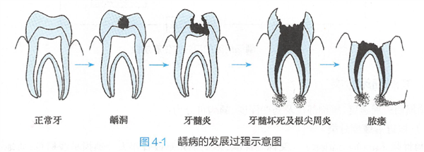 图片来自参考文献[3]