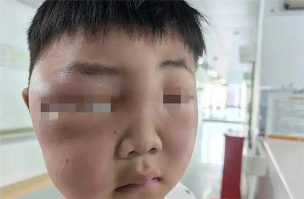 当男孩醒来时，他的脸